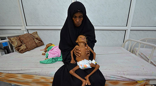 Photo of Yemen, 11,3 milioni di bambini bisognosi di assistenza umanitaria