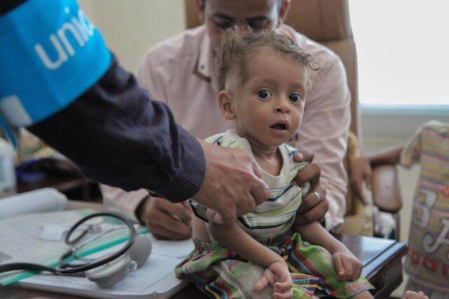 Photo of Oms: 200mila casi sospetti di colera nello Yemen
