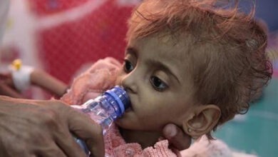 Photo of Pam: fame e disperazione nello Yemen