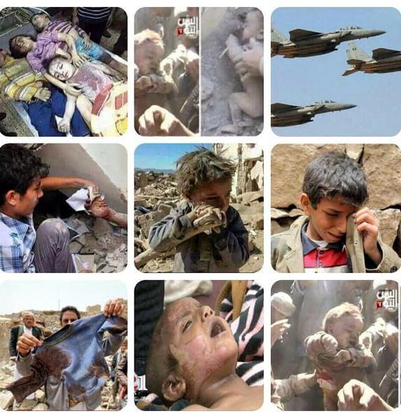 Photo of Yemen: ennesimo massacro saudita