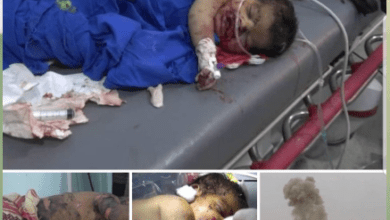 Photo of Yemen, ogni ora muoiono sei bambini