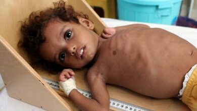 Photo of Onu: 400mila bambini yemeniti potrebbero morire di fame nel 2021