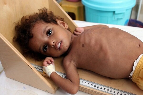 Onu-bambini-yemeniti
