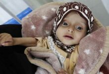 Photo of Yemen, 8mila dializzati a un passo dalla morte