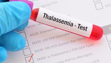 Talassemia